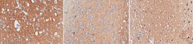 Anti-Synapsin-1 Antibody, clone 10.22 clone 10.22, from mouse