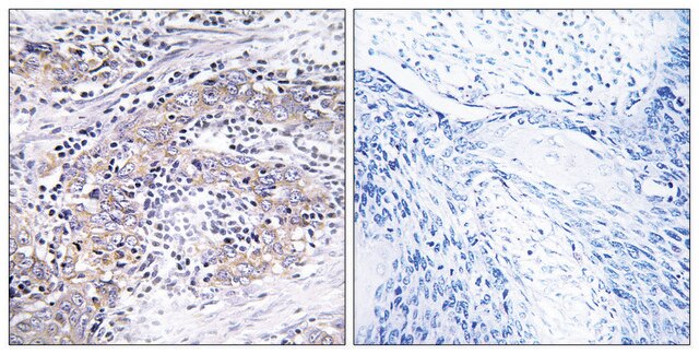 Anti-CLN6 antibody produced in rabbit affinity isolated antibody