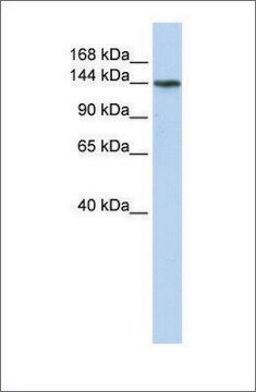 Anti-ATP11B antibody produced in rabbit affinity isolated antibody