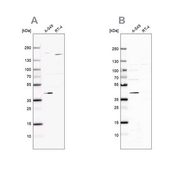 Anti-GALK1 antibody produced in rabbit Ab1, Prestige Antibodies&#174; Powered by Atlas Antibodies, affinity isolated antibody, buffered aqueous glycerol solution