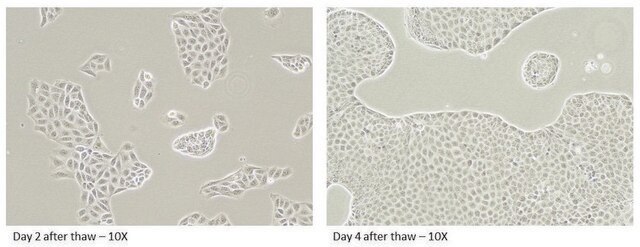 Canine MDR1 Knockout, Human BCRP Knockin MDCKII Cells