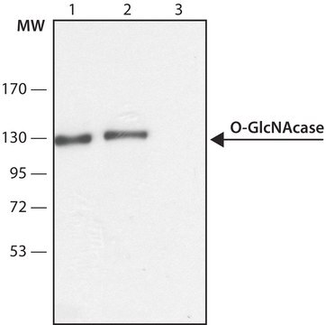 Anti-O-GlcNAcase (OGA) (C-terminal region) antibody produced in rabbit ~1.5&#160;mg/mL, affinity isolated antibody