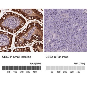 Anti-CES2 antibody produced in rabbit Prestige Antibodies&#174; Powered by Atlas Antibodies, affinity isolated antibody, buffered aqueous glycerol solution