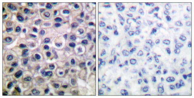 Anti-MMP-14 antibody produced in rabbit affinity isolated antibody