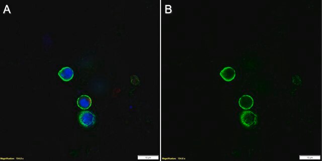 Anti-LAG3 Antibody, clone 4-10-C9 ZooMAb&#174; Mouse Monoclonal recombinant, expressed in HEK 293 cells