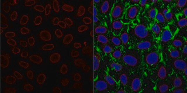 Anti-Nuclear Pore Complex Proteins Antibody, clone 414 clone 414, from mouse