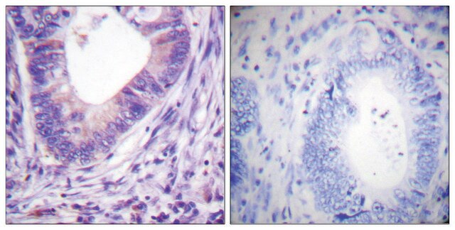 Anti-PKA &#945; antibody produced in rabbit affinity isolated antibody