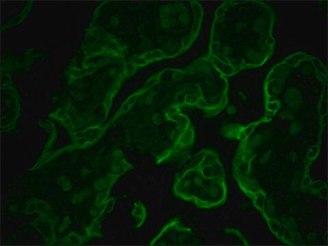 Monoclonal Anti-Cytokeratin Peptide 8 antibody produced in mouse clone M20, ascites fluid