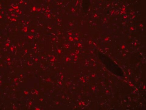 Autofluorescence Eliminator Reagent Autofluorescence Eliminator Reagent for IHC.