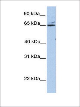 Anti-GPT2 antibody produced in rabbit affinity isolated antibody