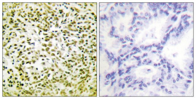 Anti-p53 antibody produced in rabbit affinity isolated antibody