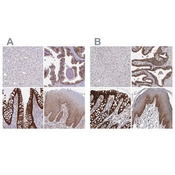 Anti-LIMA1 antibody produced in rabbit Prestige Antibodies&#174; Powered by Atlas Antibodies, affinity isolated antibody, buffered aqueous glycerol solution