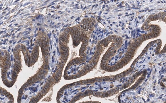 Anti-PKC&#953; Antibody, clone 1J13 ZooMAb&#174; Rabbit Monoclonal recombinant, expressed in HEK 293 cells