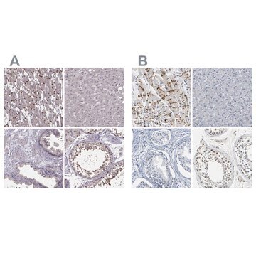 Anti-PKP2 antibody produced in rabbit Prestige Antibodies&#174; Powered by Atlas Antibodies, affinity isolated antibody