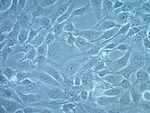 Humane Kardiomyozyten-Zelllinie AC16 AC16 Human Cardiomyocytes can be serially passaged and can differentiate when cultured in mitogen-free medium. The cells may be used to study developmental regulation of cardiomyocytes.