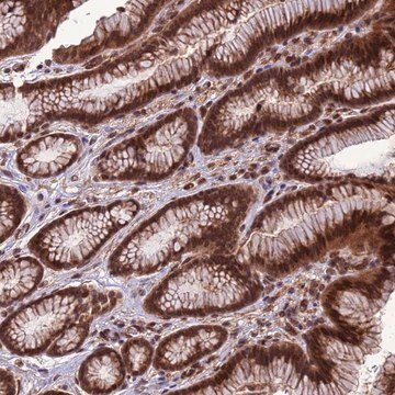 Anti-VSTM4 antibody produced in rabbit Prestige Antibodies&#174; Powered by Atlas Antibodies, affinity isolated antibody, buffered aqueous glycerol solution