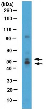 Anti-Nuclear factor 1/C Antibody serum, from rabbit