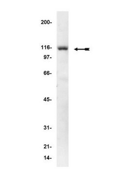 Anti-&#945;-Actinin Antibody, clone AT6/172 clone AT6/172, Upstate&#174;, from mouse