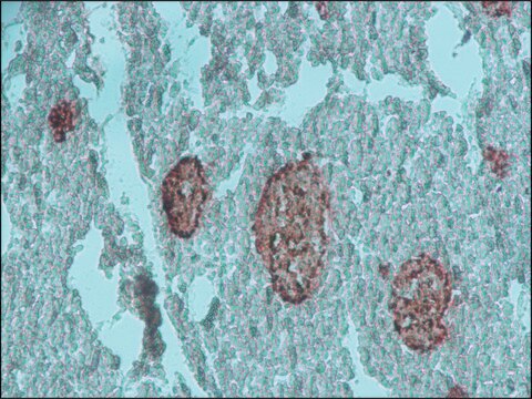 Anti-Chromogranin A antibody produced in rabbit affinity isolated antibody