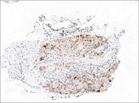 Anti-TRPA1 antibody produced in rabbit affinity isolated antibody