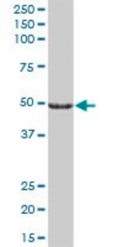 Anti-CYP27A1 antibody produced in mouse IgG fraction of antiserum, buffered aqueous solution