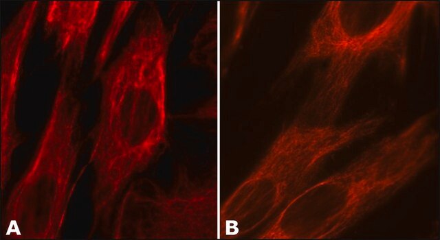 Anti-Vimentin antibody, Mouse monoclonal clone LN-6, purified from hybridoma cell culture