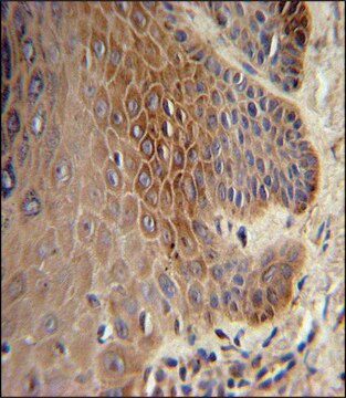 ANTI-COL17A1 (CENTER) antibody produced in rabbit IgG fraction of antiserum, buffered aqueous solution