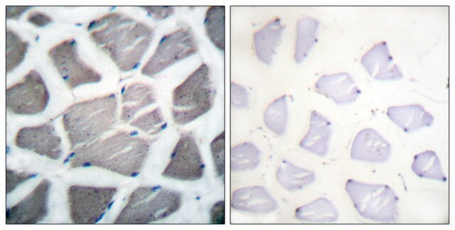 Anti-BAK antibody produced in rabbit affinity isolated antibody