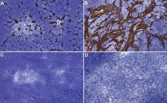 Anti-Reticular fibroblasts Antibody, clone ER-TR7