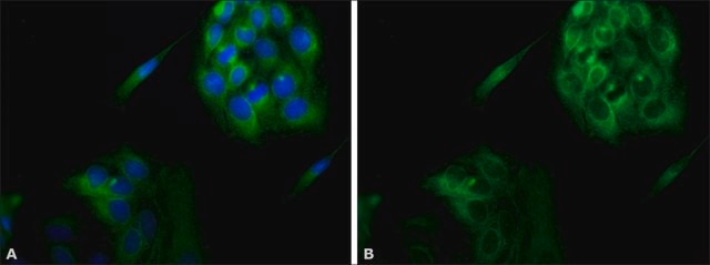 Anti-Calnexin antibody produced in rabbit IgG fraction of antiserum, buffered aqueous solution