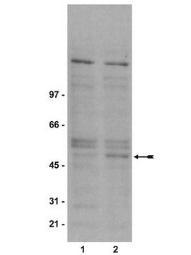 Anti-phospho-GSK3&#946; (Ser9) Antibody, clone 2D3 clone 2D3, Upstate&#174;, from mouse