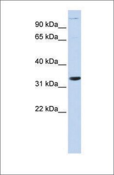 Anti-ANP32B antibody produced in rabbit affinity isolated antibody