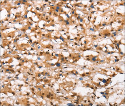 Anti-DGAT1 antibody produced in rabbit affinity isolated antibody