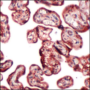 Anti-PI3K P85 antibody, Rabbit monoclonal clone SP62, recombinant, expressed in proprietary host, affinity isolated antibody