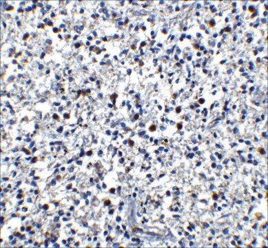 Anti-Cathelicidin antibody produced in rabbit affinity isolated antibody, buffered aqueous solution