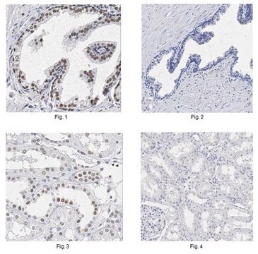 Anti-P40 Antibody, clone 11F12.1 clone 11F12.1, from mouse