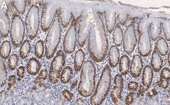 Anti-MUC5AC Antibody, clone CLH2 ZooMAb&#174; Mouse Monoclonal recombinant, expressed in HEK 293 cells