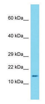 Anti-Saa1 antibody produced in rabbit affinity isolated antibody