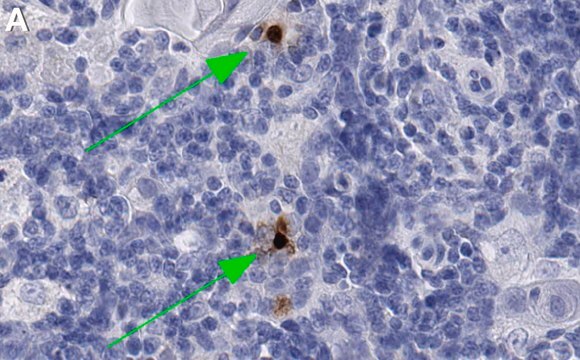 Anti-CXCL10 Antibody, clone 3F14 ZooMAb&#174; Rabbit Monoclonal recombinant, expressed in HEK 293 cells