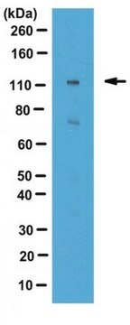 Anti-MuSK Antibody serum, from rabbit