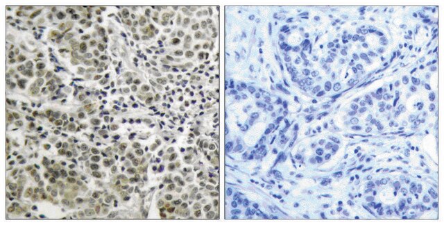 Anti-Androgen Receptor antibody produced in rabbit affinity isolated antibody