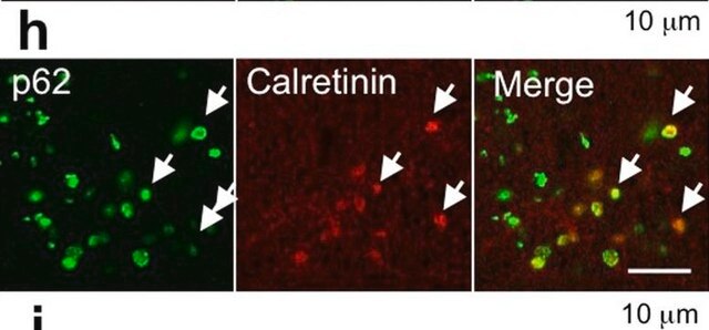 Anti-Calretinin-Antikörper, Klon&nbsp;6B8.2 clone 6B8.2, Chemicon&#174;, from mouse