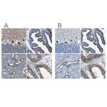 Anti-STIM1 antibody produced in rabbit Prestige Antibodies&#174; Powered by Atlas Antibodies, affinity isolated antibody, buffered aqueous glycerol solution