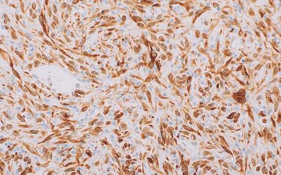 MDM2 (IF2) Mouse Monoclonal Antibody