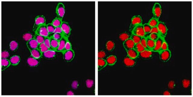 Anti-Estrogen Receptor &#945; Antibody, clone F3-A ascites fluid, clone F3-A, from mouse