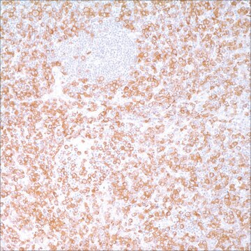 ALK Protein (ALK-1) Mouse Monoclonal Antibody