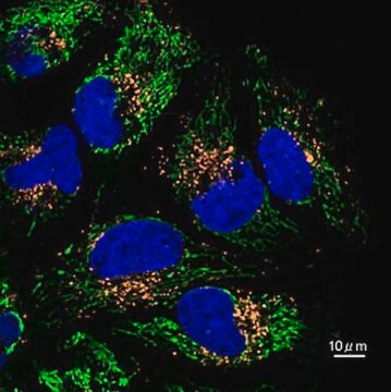 BioTracker&nbsp;560 Lysosom-Farbstoff, orange Live cell imaging dye for acidic cellular organelles such as lysosomes.