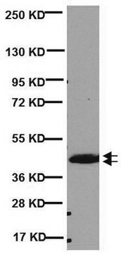 Anti-CNPase Antibody, clone 11-5B clone 11-5B, Chemicon&#174;, from mouse