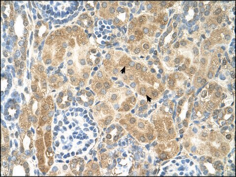 Anti-NR2F2 (AB2) antibody produced in rabbit IgG fraction of antiserum