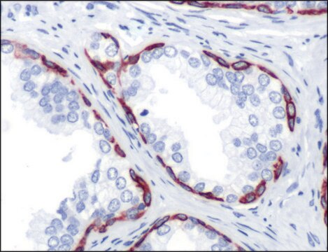 Anti-Keratin 14 antibody, Rabbit monoclonal clone SP53, recombinant, expressed in proprietary host, affinity isolated antibody